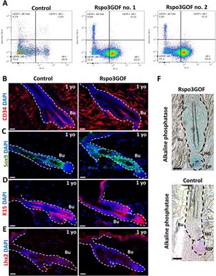 The overexpression of R-spondin 3 affects hair morphogenesis and hair development along with the formation and maturation of the hair follicle stem cells